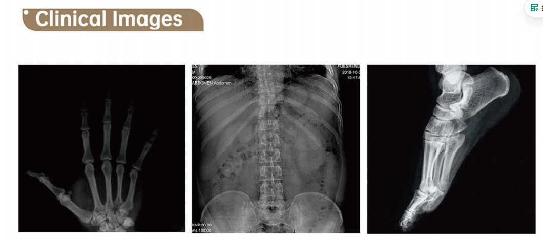 Digital X-ray Radiography System - 5